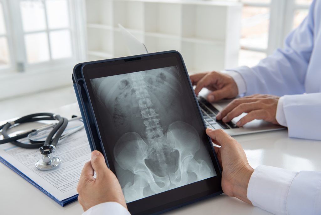 A doctor reviewing a spinal xray on a tablet